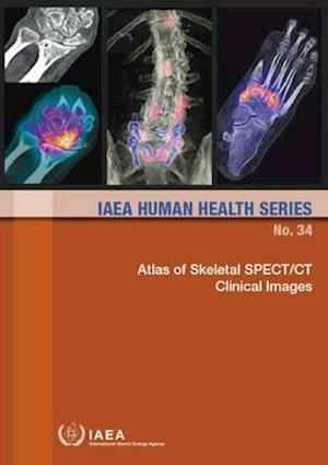 Atlas of Skeletal Spect/CT Clinical Images