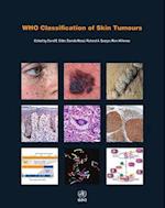 Who Classification of Skin Tumours
