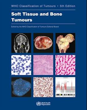 Soft Tissue and Bone Tumours