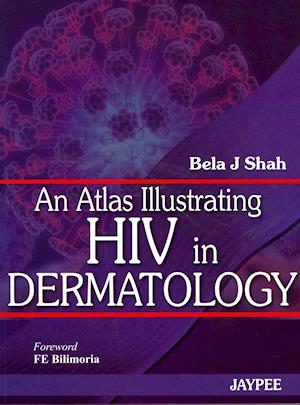 An Atlas Illustrating HIV in Dermatology