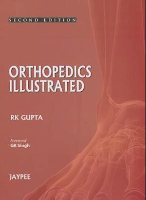 Orthopedics Illustrated