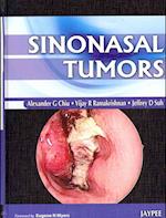 Sinonasal Tumors