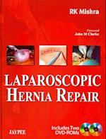 Laparoscopic Hernia Repair