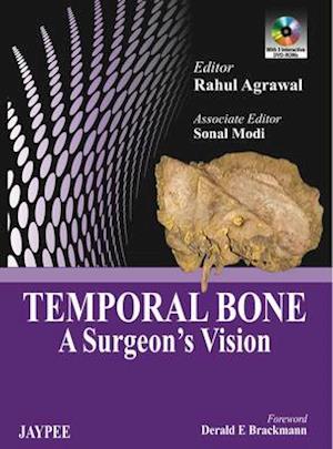 Temporal Bone