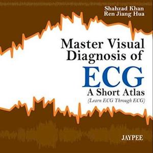 Master Visual Diagnosis of ECG: A Short Atlas (Learn ECG through ECG)