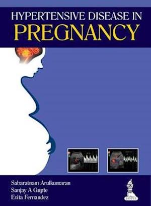 Hypertensive Disease in Pregnancy