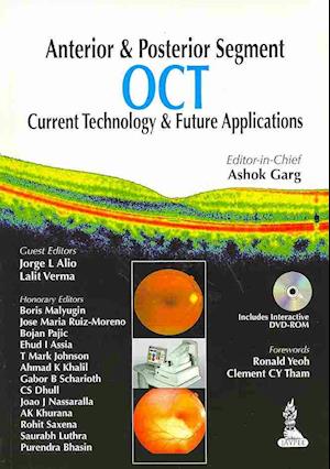 Anterior & Posterior Segment OCT: Current Technology & Future Applications