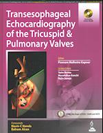 Transesophageal Echocardiography of the Tricuspid & Pulmonary Valves