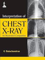 Interpretation of Chest X-Ray