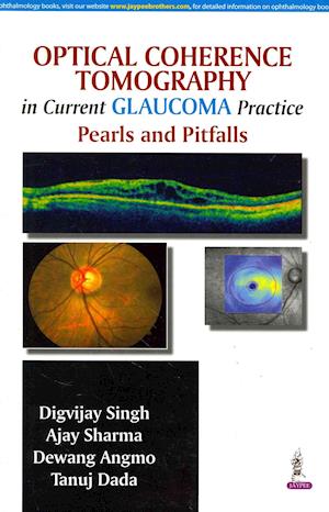 Optical Coherence Tomography in Current Glaucoma Practice
