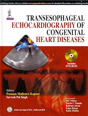 Transesophageal Echocardiography of Congenital Heart Diseases