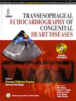 Transesophageal Echocardiography of Congenital Heart Diseases