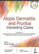 Atopic Dermatitis and Pruritus