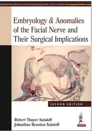 Embryology & Anomalies of the Facial Nerve and Their Surgical Implications