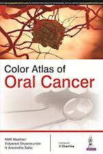 Masthan, K: Color Atlas of Oral Cancer