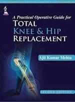 A Practical Operative Guide for Total Knee and Hip Replacement