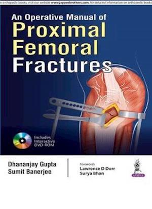 An Operative Manual of Proximal Femoral Fractures