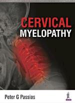 Cervical Myelopathy