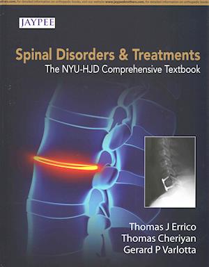 Spinal Disorders & Treatment: The NYU-HJD Comprehensive Textbook