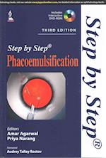 Step by Step Phacoemulsification