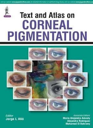 Text and Atlas on Corneal Pigmentation