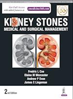 Kidney Stones