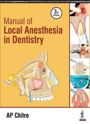 Manual of Local Anaesthesia in Dentistry