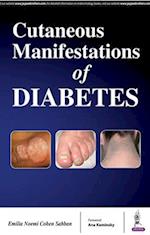 Cutaneous Manifestations of Diabetes