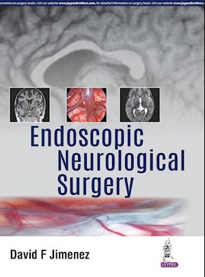 Endoscopic Neurological Surgery