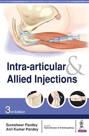 Intra-articular & Allied Injections