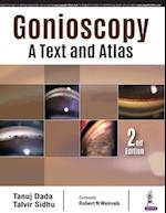 Gonioscopy: A Text and Atlas