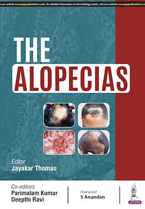 The Alopecias