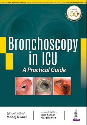 Bronchoscopy in ICU: A Practical Guide