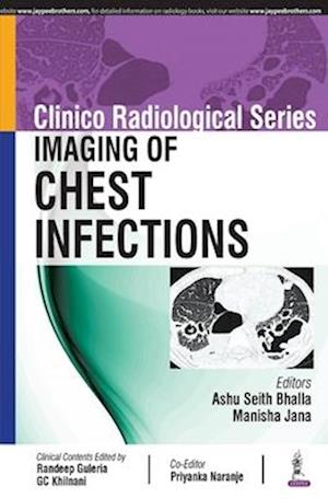 Clinico Radiological Series: Imaging of Chest Infections