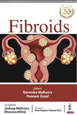 FIBROIDS