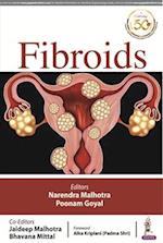 FIBROIDS