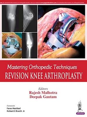 Mastering Orthopedic Techniques: Revision Knee Arthroplasty