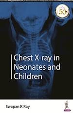 Chest X-ray in Neonates and Children