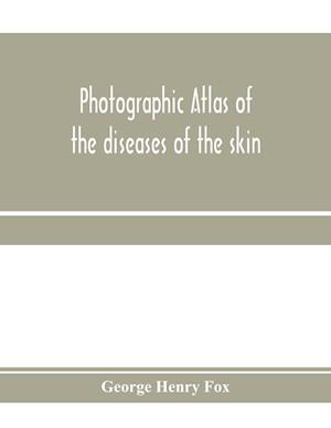 Photographic atlas of the diseases of the skin; A Series of Eighty Plates, Comprising more than One Hundred Illustrations, with Descriptive text, and a Treatise on Cutaneous Therapeutics