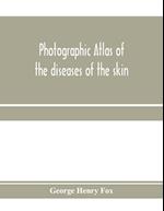 Photographic atlas of the diseases of the skin; A Series of Eighty Plates, Comprising more than One Hundred Illustrations, with Descriptive text, and a Treatise on Cutaneous Therapeutics