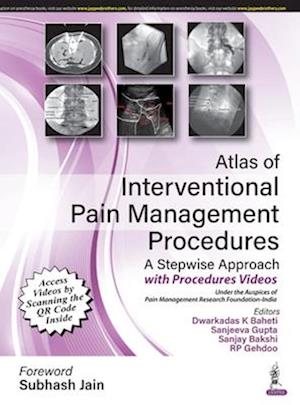 Atlas of Interventional Pain Management Procedures