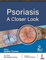 Psoriasis