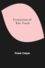 Extraction of the Teeth 