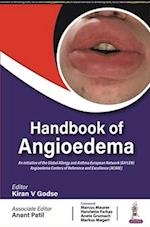 Handbook of Angioedema 