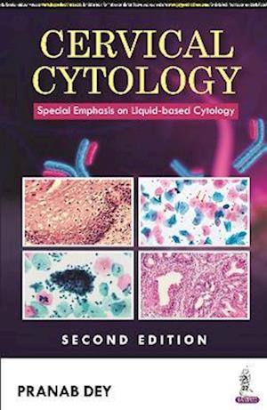 Cervical Cytology : Special Emphasis on Liquid-based Cytology