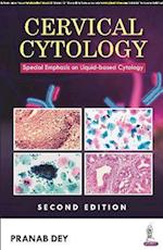 Cervical Cytology : Special Emphasis on Liquid-based Cytology 