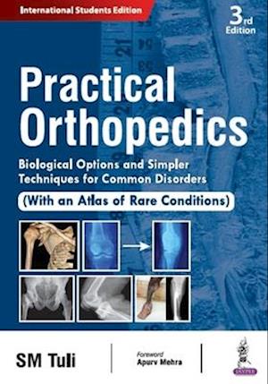 Practical Orthopedics : Biological Options and Simpler Techniques for Common Disorders