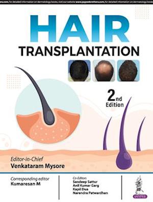 Hair Transplantation