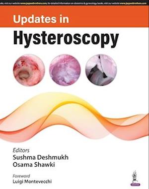 Updates in Hysteroscopy