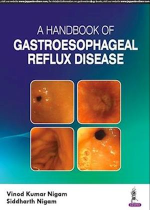 A Handbook of Gastroesophageal Reflux Disease (GERD)